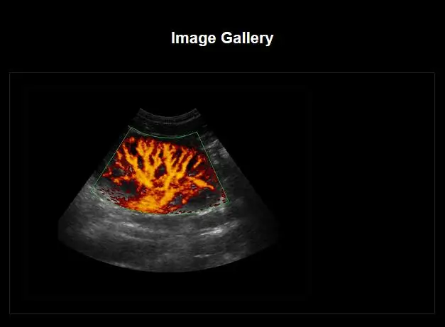 Sonoscape S6 Portable 4D Color Doppler Ultrasound For Human