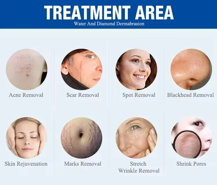 Aqua Peel Diamond Microdermabrasion Deep Cleaning dermabrasion Machine For Face Cleaning