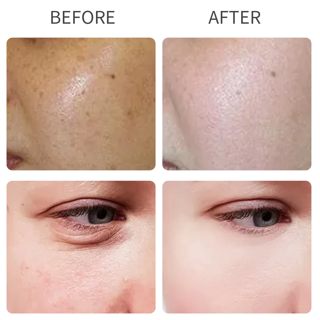 Private Label 24k Gold Collagen Facial Mask Anti-wrinkle Skin Care Whitening Eye Patch Moisturizing Gold Face Mask