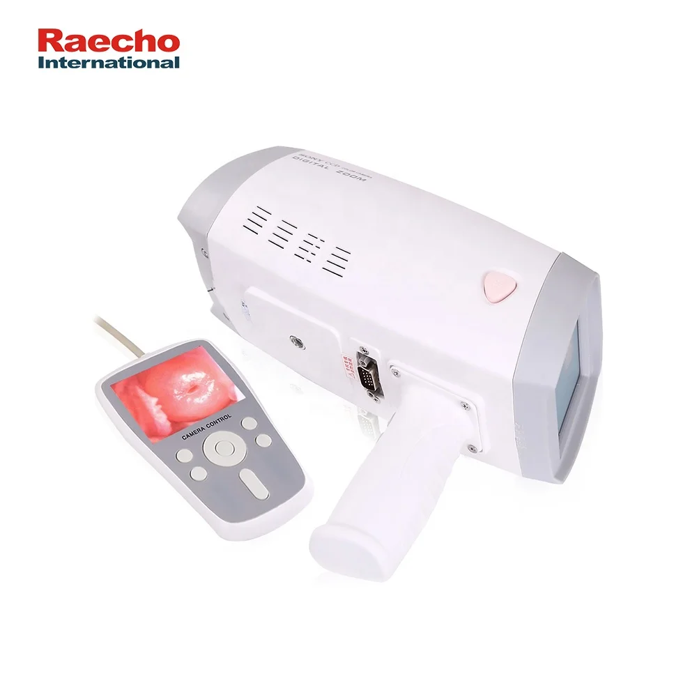 Good Quality Handheld Video Colposcope Digital Gynecology Hospital Convenient