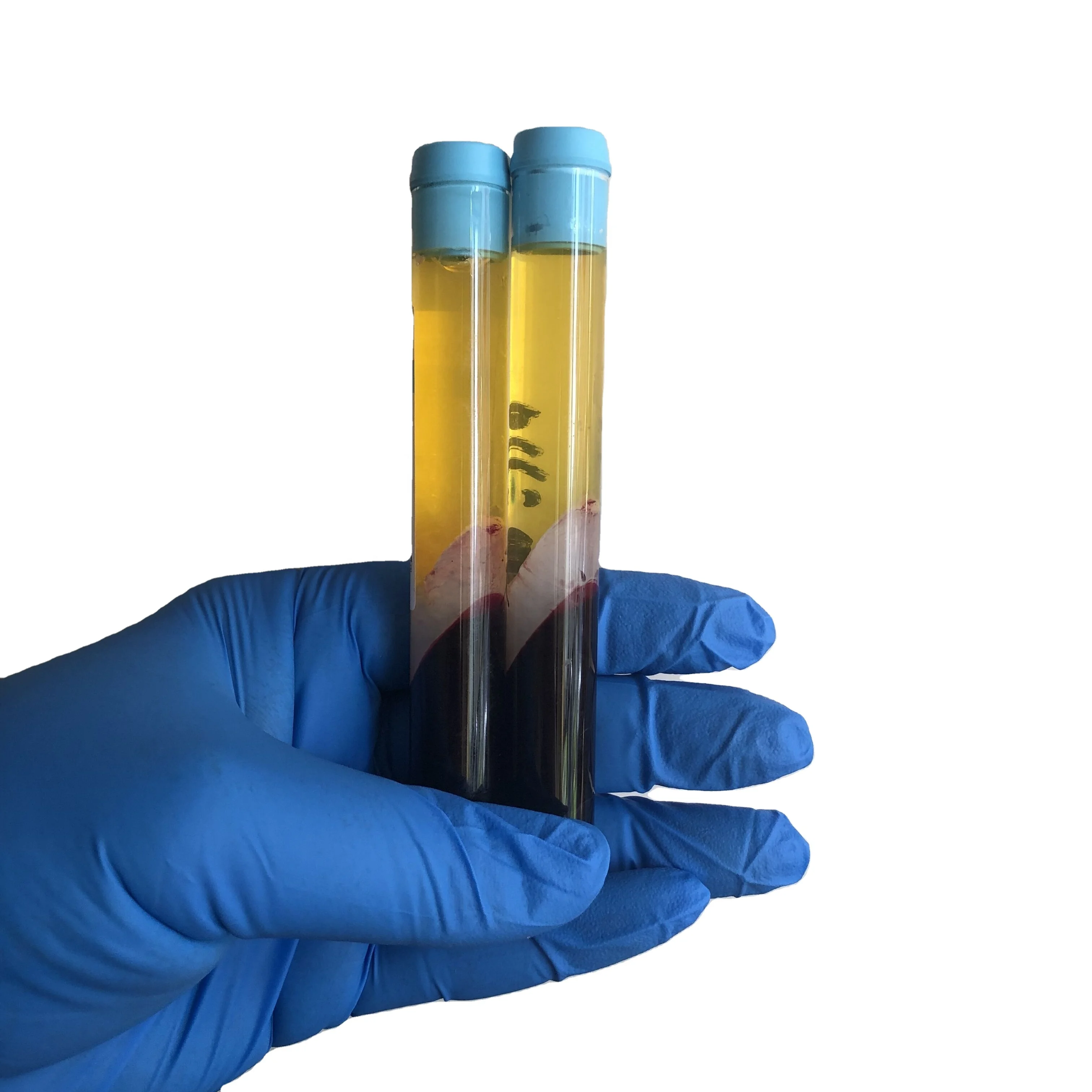 Hot selling Sodium Citrate Vacuum prp tube  prp tube 10ml with acd gel  for skin rejuvenation