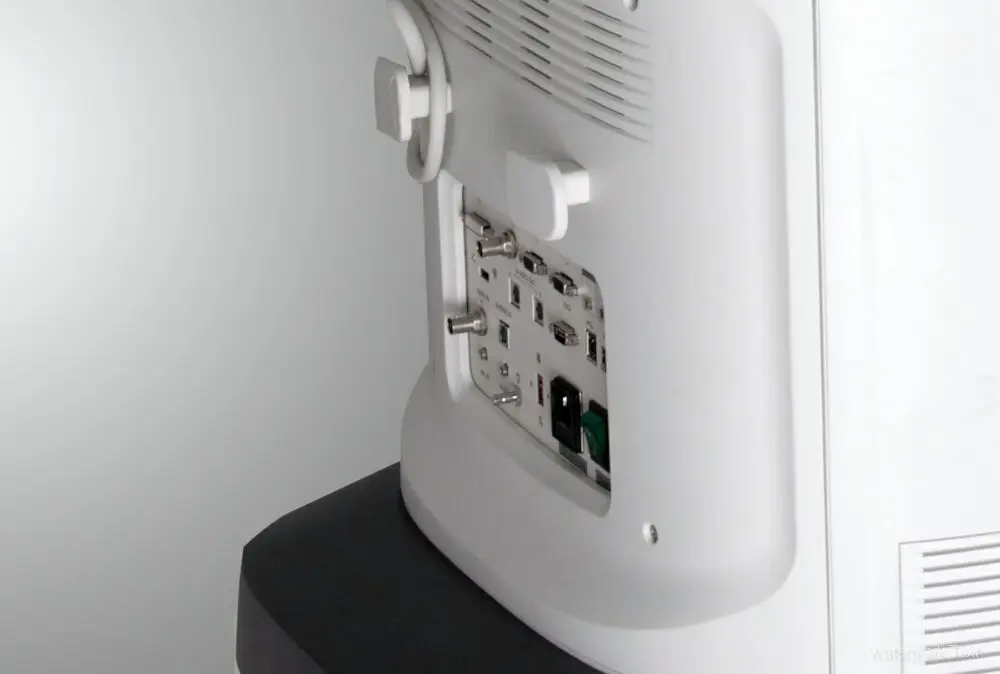 Ультразвук Sonoscape s50 4d лучше чем mindray dc 70