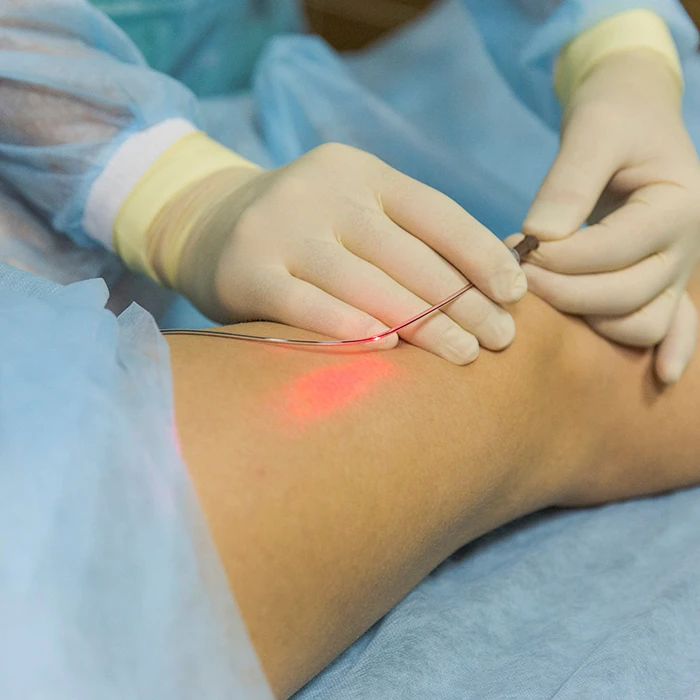 TRIANGEL 980 1470nm Endovenous Laser Varicose Veins Therapy EVLT Endovascular Laser Ablation Clinic Device