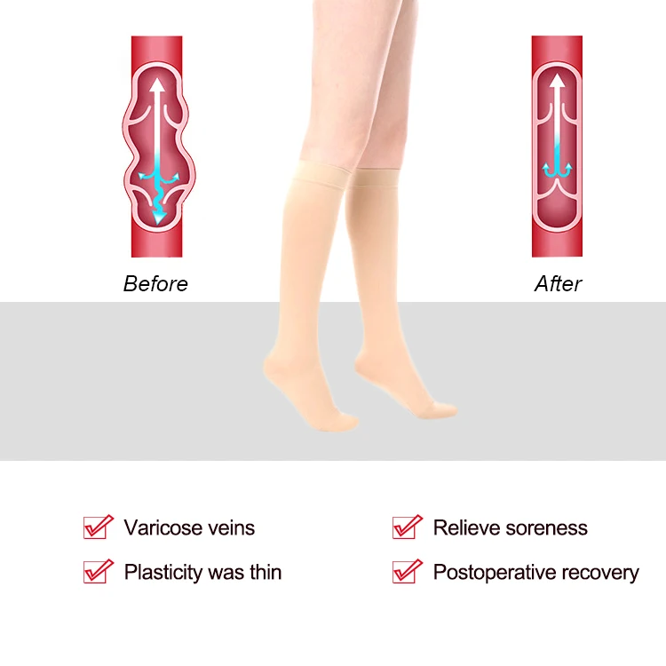 Enerup custom nylon black flesh-colored unisex socks Antibacterial 15-20mmhg calf socks compression socks medical