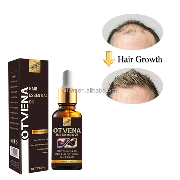 Women Men Anti Hair Loss Treatment Organic Ginger Hair Growth Oil For Hair Regrowth Spray