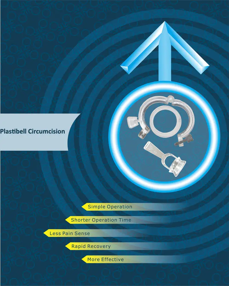 Small Size Disposable Sterile Male Foreskin Ring Cutting Circumcision Stapler Circumcision Device for Children prepuce