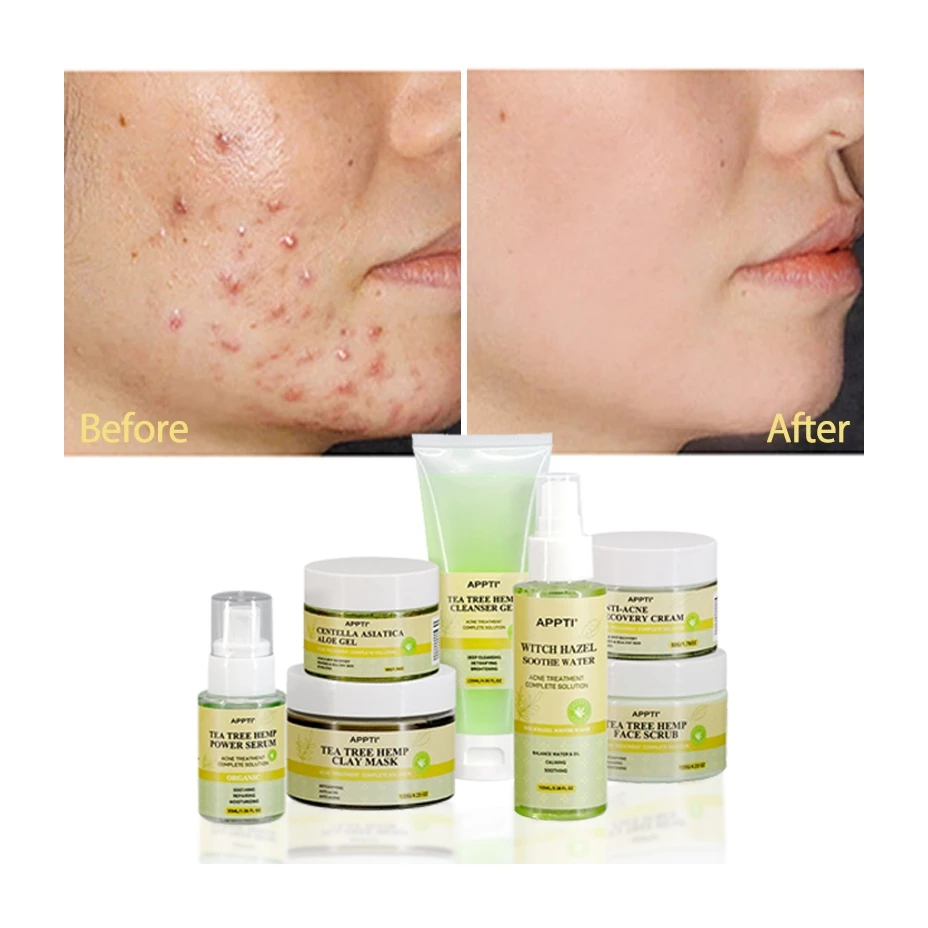 Продукты для отбеливания и ухода за кожей чайного дерева полный набор травяная Сыворотка лица Органическая Фирменная торговая марка от