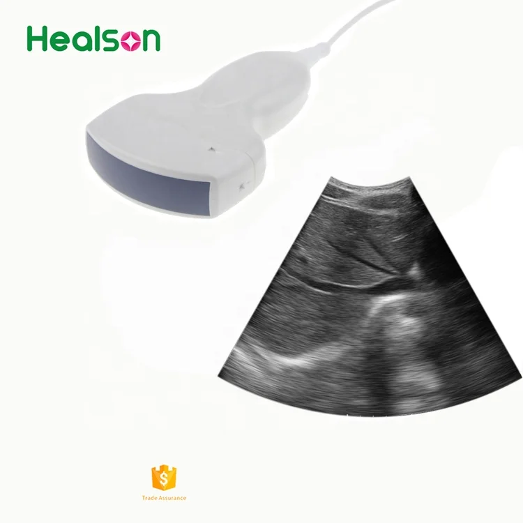 
Самый дешевый портативный ультразвуковой USB-аппарат Healson UP20 для телефонов/ноутбуков/компьютеров от производителя в Китае 