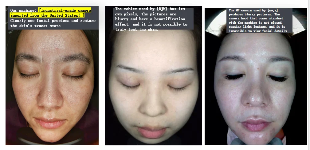 Faling AI Skin Analyzer with Moisture  pen! 9 Spectrum 19 Test Dimensions Blue light disinfection AISIA Detector 16 Languages