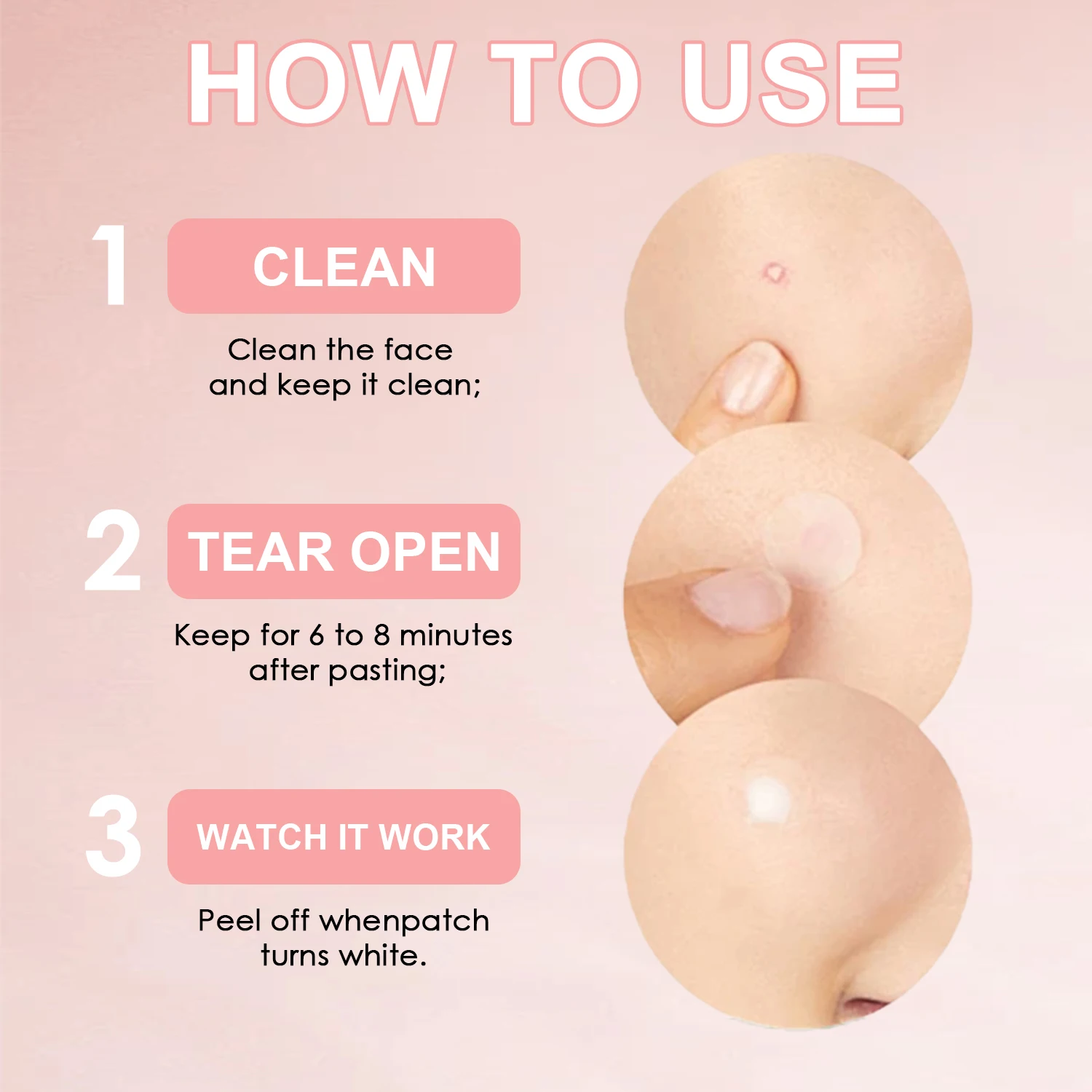 Private Label Hydrocolloid Acne Pimple Patch for Covering Zits and Blemishes