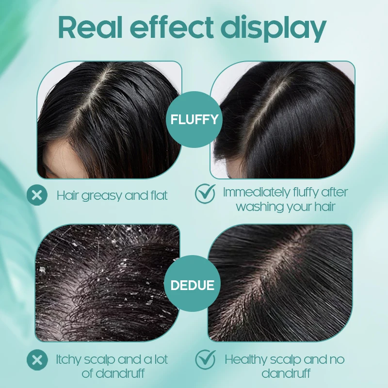 Jotigo Natural Plant Extracts Organic Hair Care Treatment Anti-Dandruff Hair Oil Serum Brighten Organic Hair Oil
