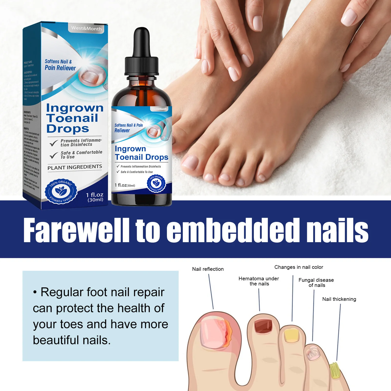 WestMonth 30ml plant  ingredients ingrown toenail drop liquid toenail fungus treatment pain