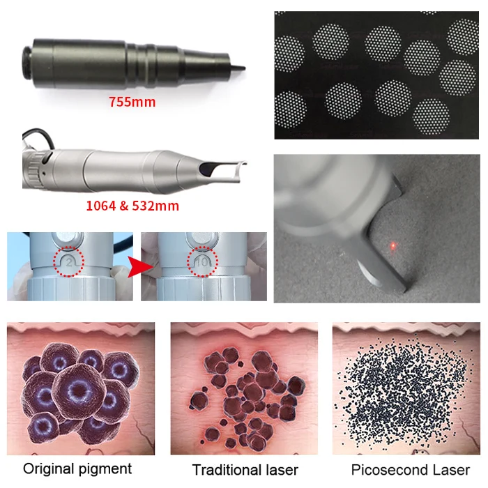 Laser Picosecond Tattoo Pigment Removal Eyebrow Tattoo Removal Remover Beauty Machine Price