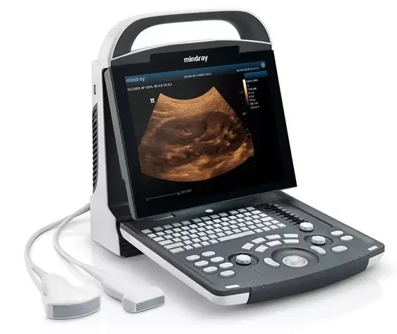 DP 10 mindray portable full digital medical ultrasound scanner machine B/W mindray ultrasound machine