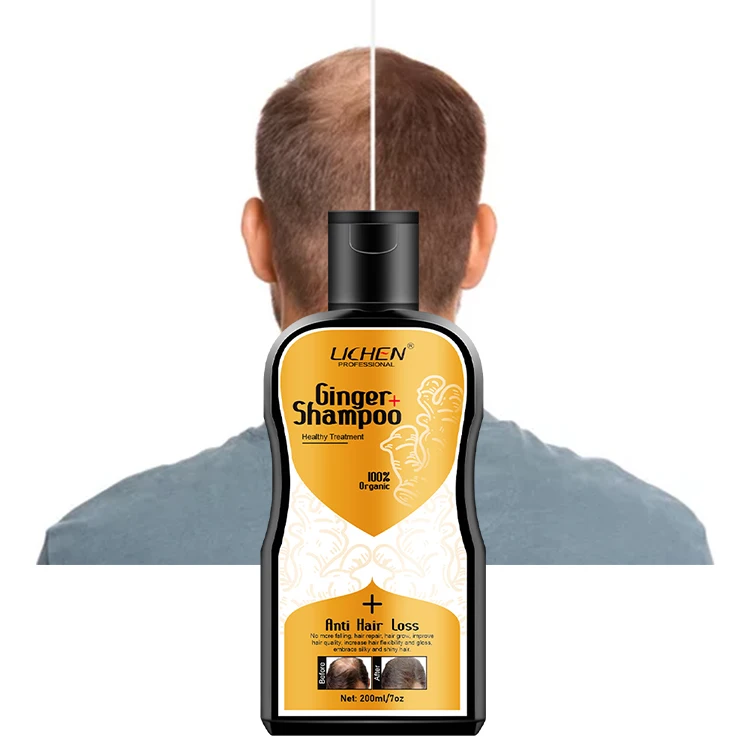 100% herbal plant ginseng anti-dandruff shampoo hair falling ginger shampoo hair loss
