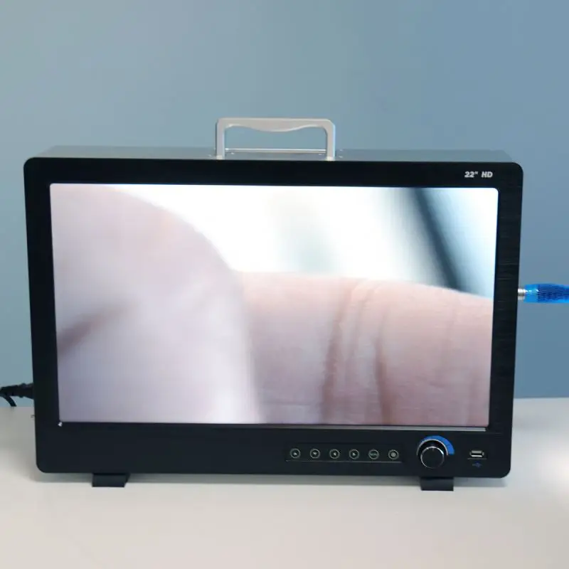 Medical ENT Endoscopy 1080P Full HD Digital Portable USB All-in-one Endoscope Camera System