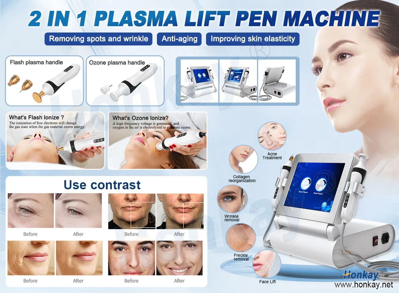 Professional ozone shower plasma pen acne treatment face lift skin tightening machine jet cold plasma device
