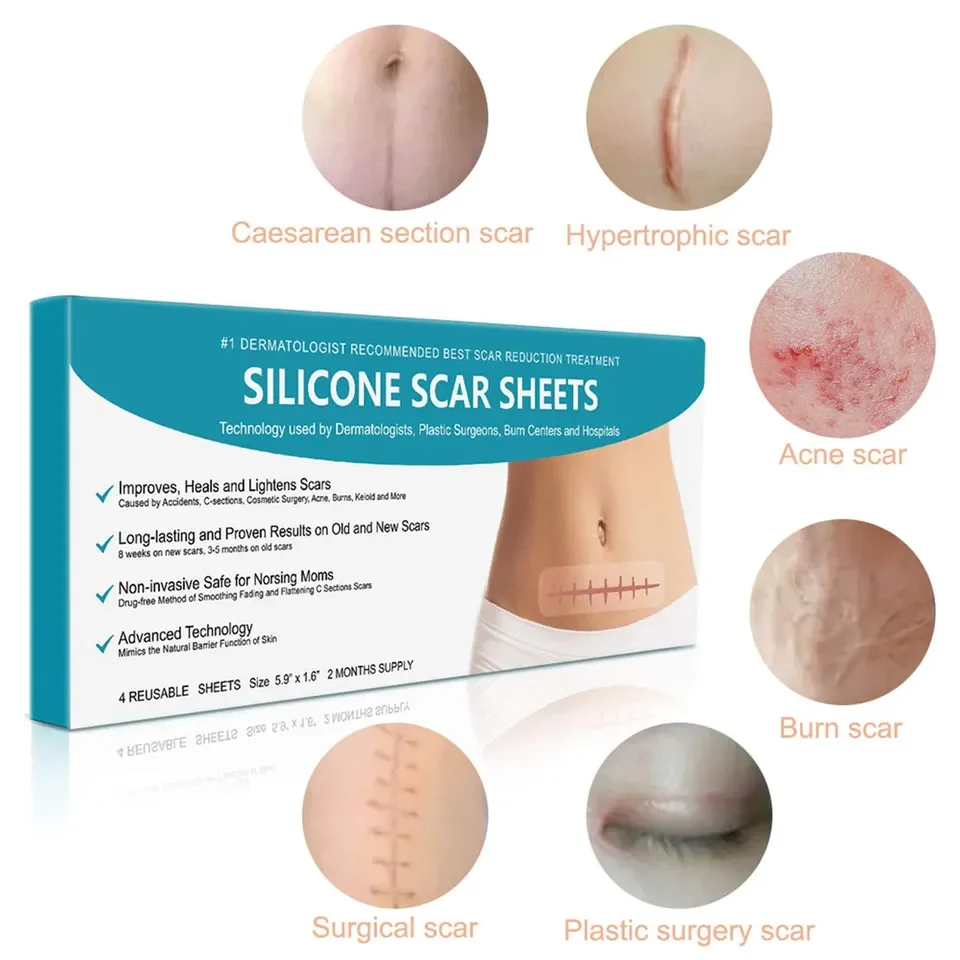 Silicone Scar Removal for Scars Caused by C-Section Surgery Burn Acne Works on Old & New Scars Reusable Sheets
