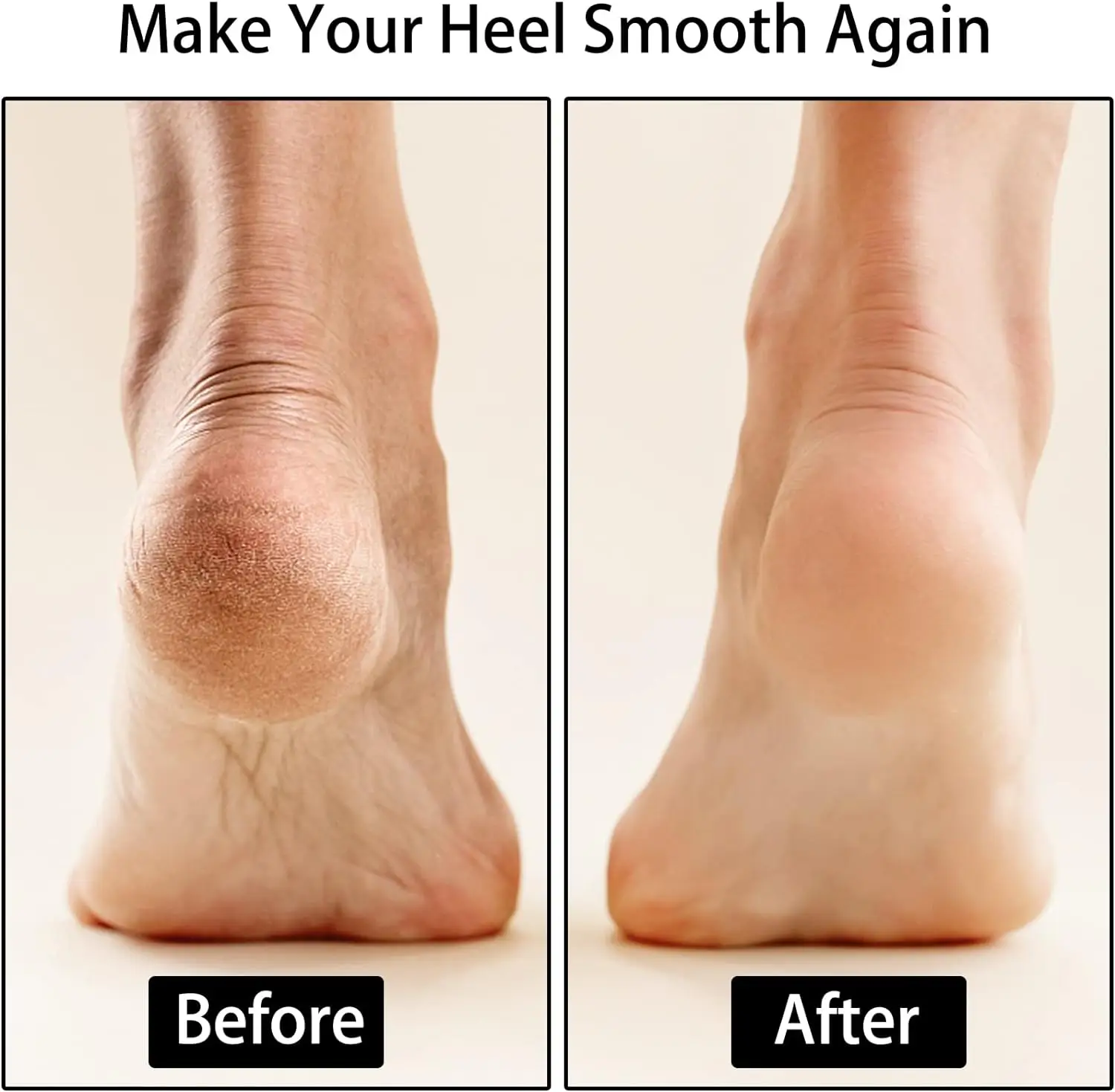 Wholesale 100% Cotton Defying Foot Protection Socks Intensive Moisture Repair Ankle Sleeves Sports Stabilizer Dry Cracked Skin