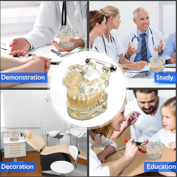 Medical science transparent dental teaching tooth model with nerves for medicine pathological tooth model