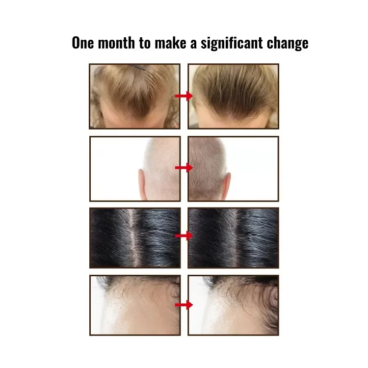 Non-allergic Natural Material Mint Thickening Anti Hair Loss Shampoo and Conditioner Set for sensitive scalp