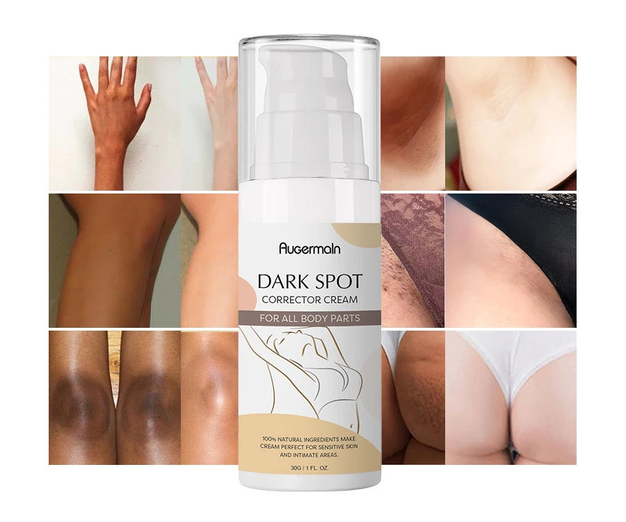 OEM Moisturizing Anti Freckle Whitening Cream Armpit Underarm Body Sensitive Areas Dark Spot Remover Cream
