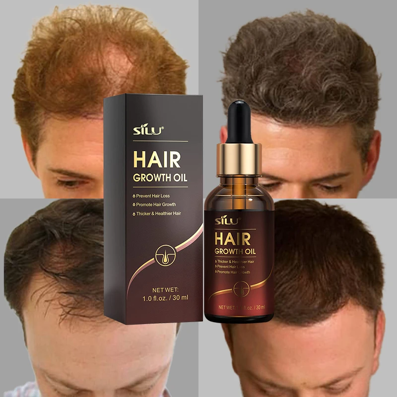 Схема волос jataa solum black american top ginger hair grow oil для роста у