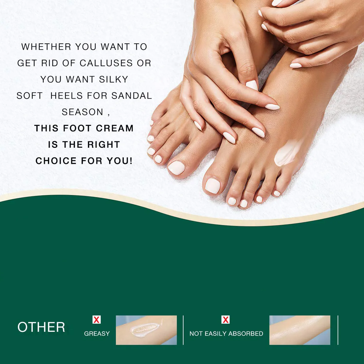 Best Hand And Foot Whitening Cream Foot Cream Deep Repair Callus Remover Foot Peeling Cream For Cracked Heels