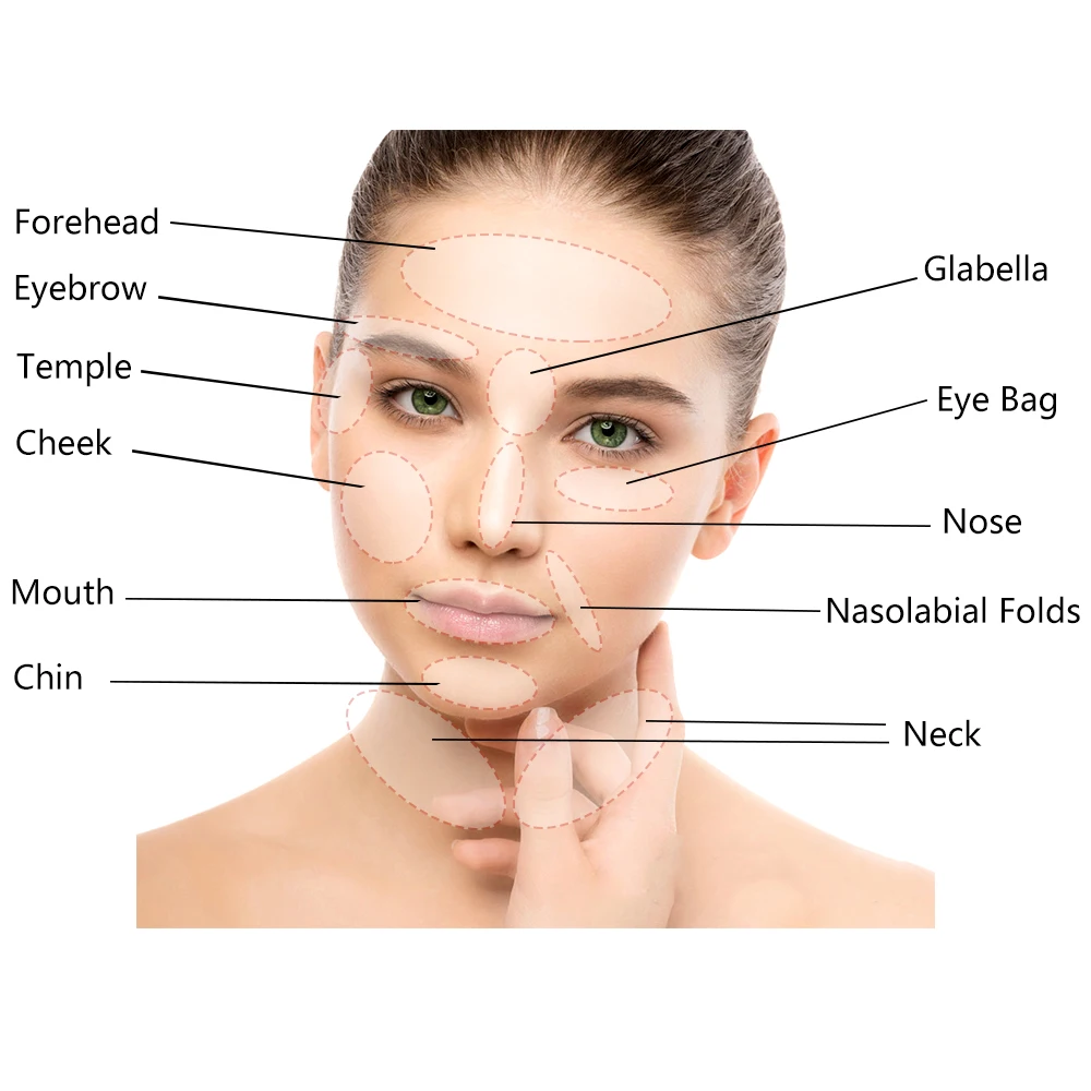 Hot Selling Beauty Salon 25g 60mm Mini Cog Screw Face Lifting Pdo Thread