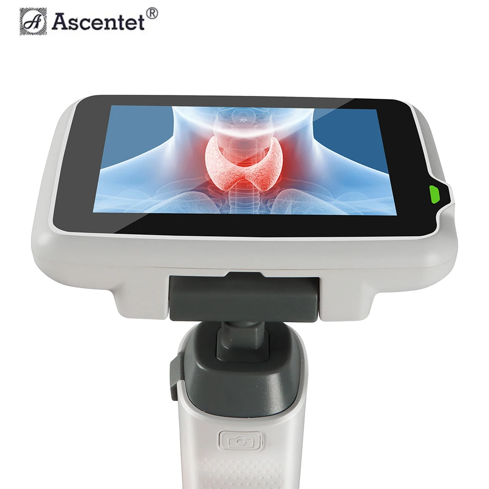 High-quality medical equipment Smartscope VL Pro video laryngoscope