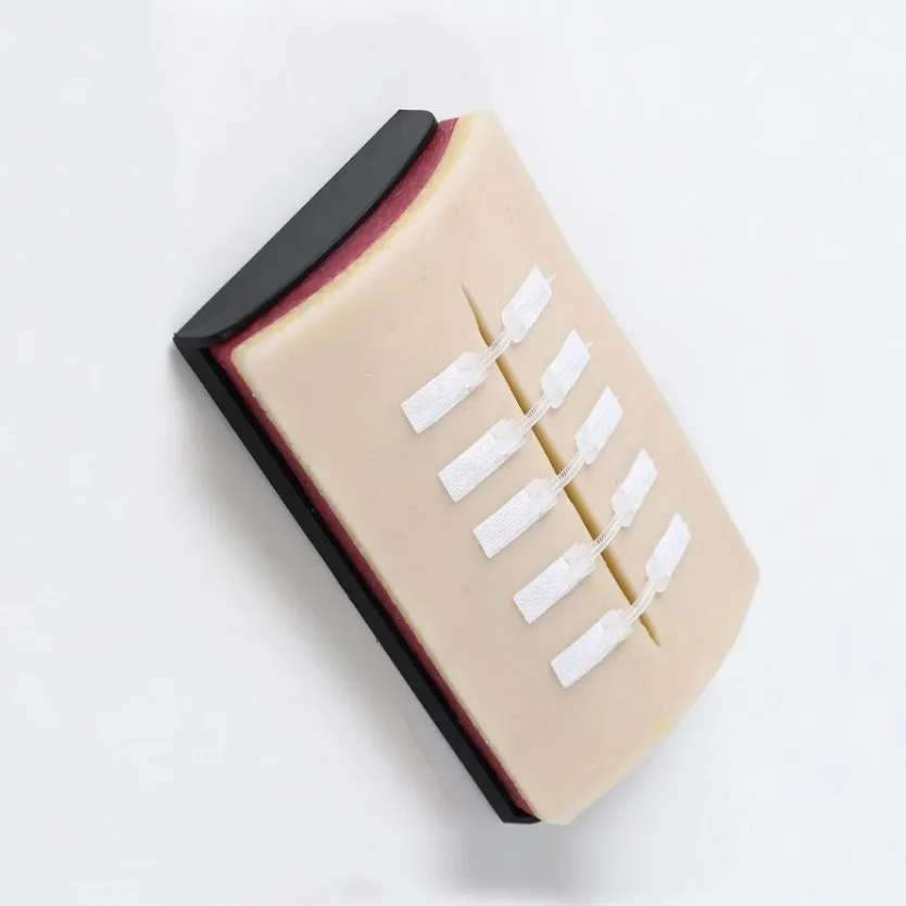 Система застежки ран без стежков быстрое нанесение набор застежек на молнии