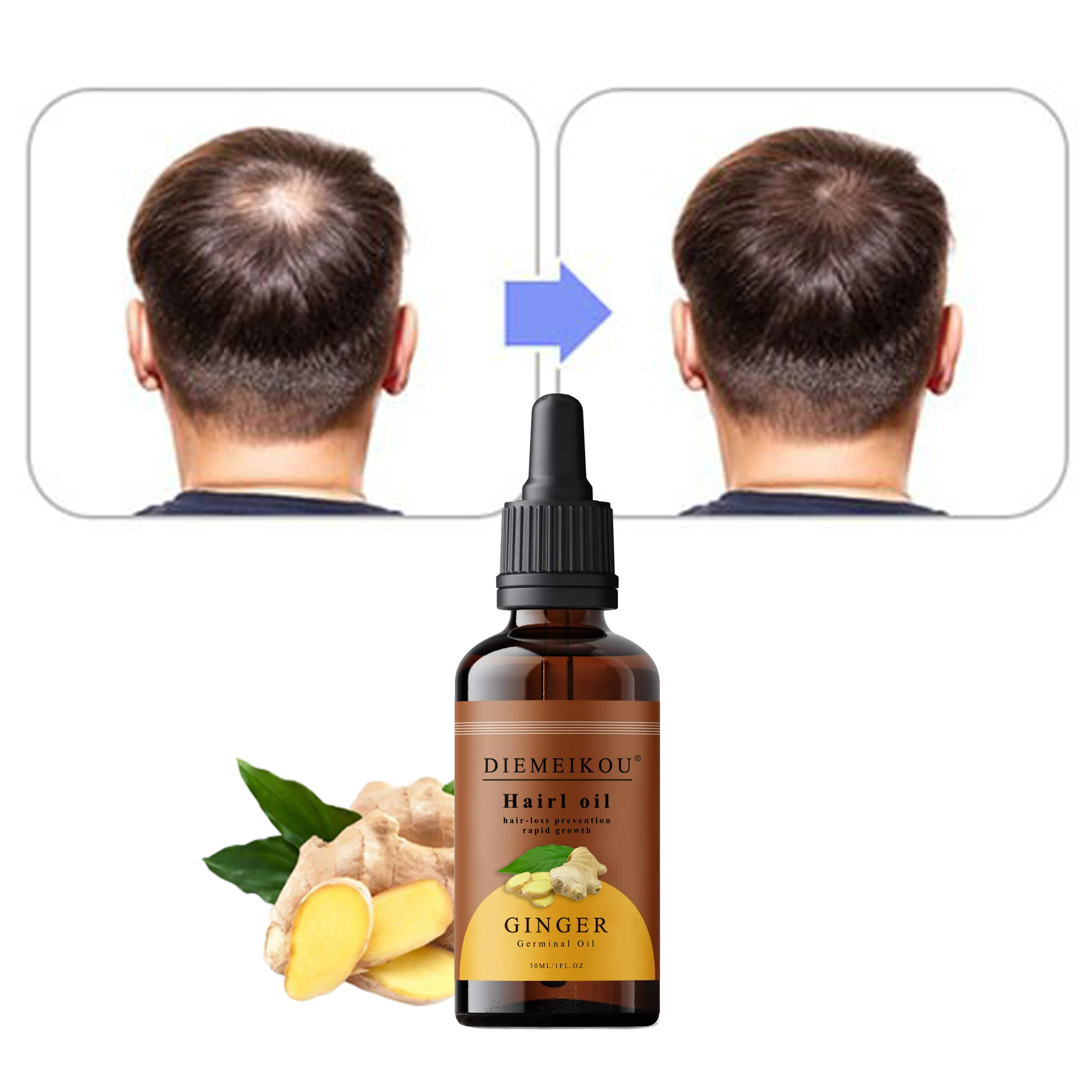 OEM 100% Natural private label wild regrowth castor organic black women argan oil softee onion beard fast hair growth oil