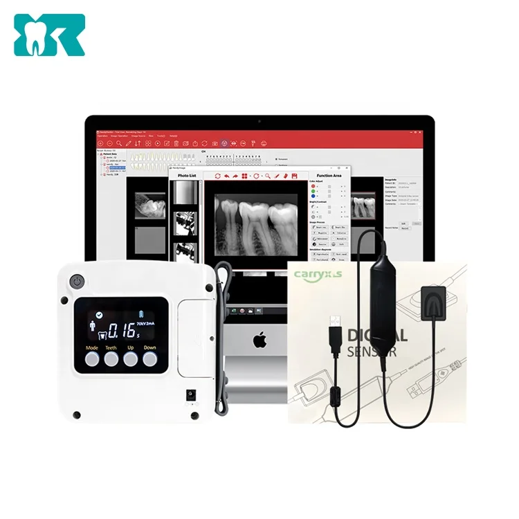 High Frequency Dental Portable Digital X-Ray Machine With Intraoral Rvg Sensor