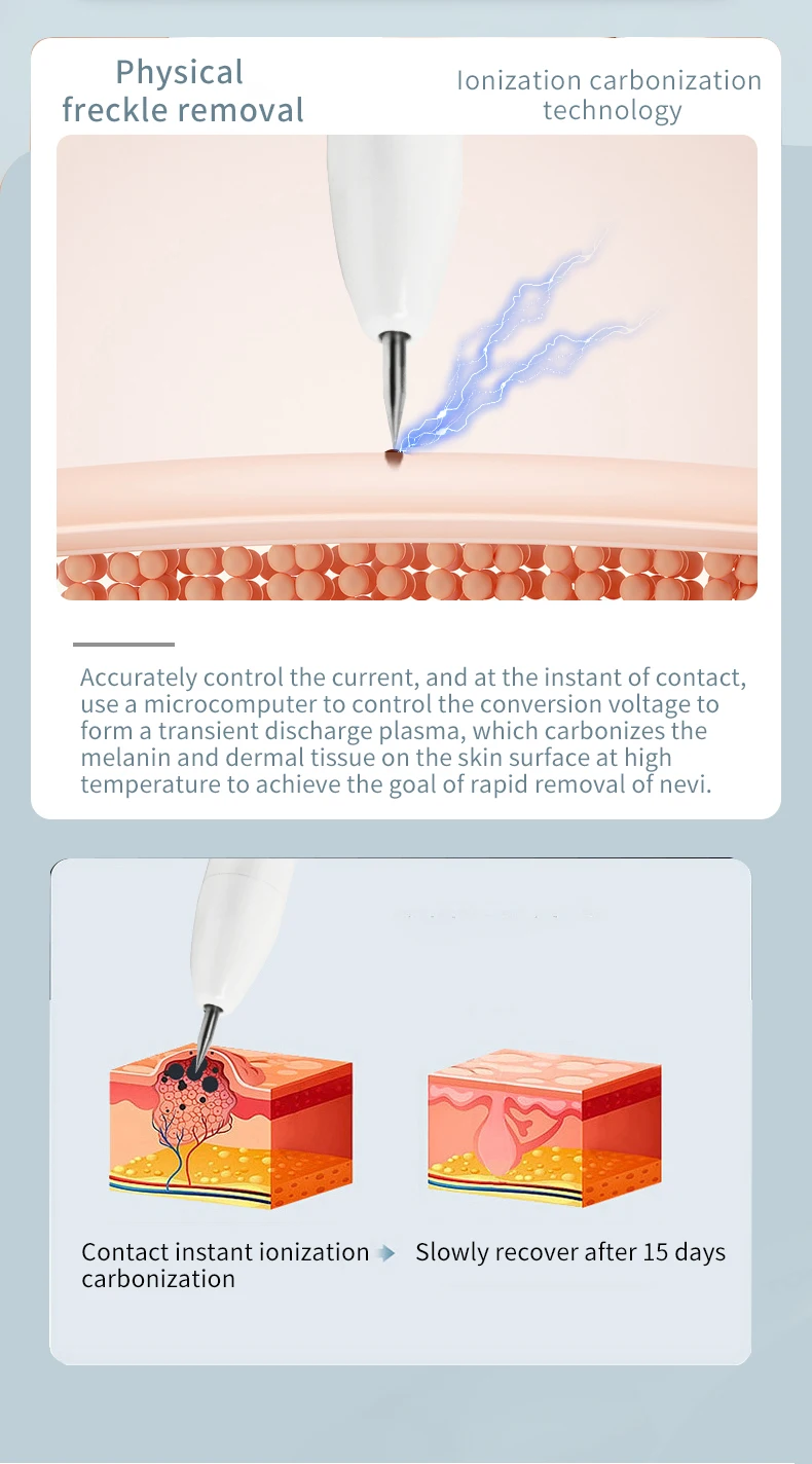 5g Freckle Removal Device Pigment Removal Device Portable Nevus Remove Machine