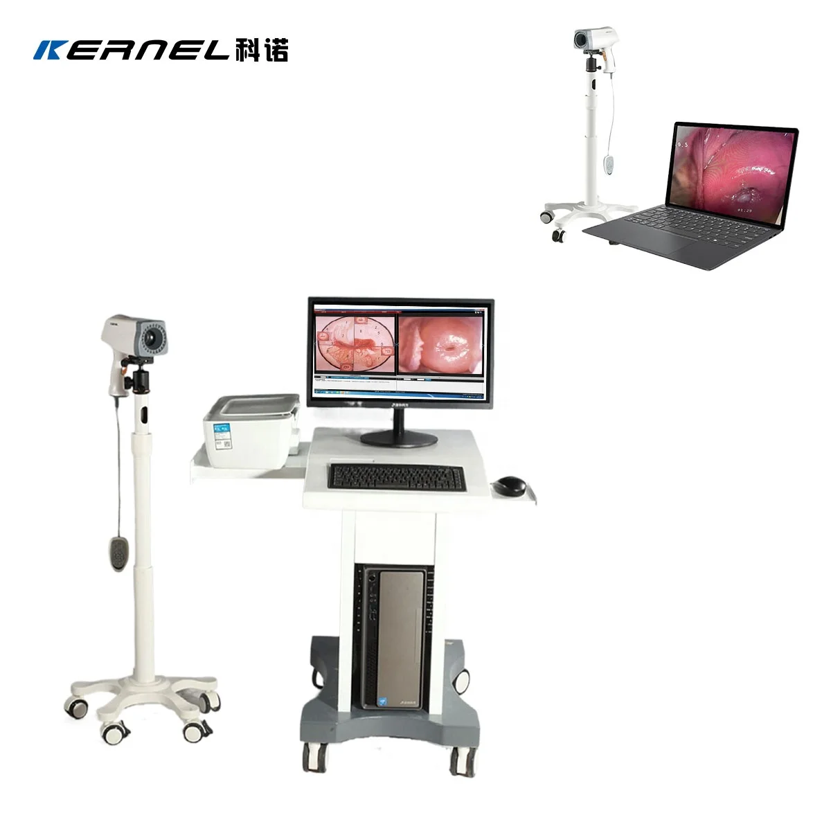Kernel Portable Mini Trolley type Medical Digital Electronic Colposcope Video China Electronic Colposcope Price For Gynecology