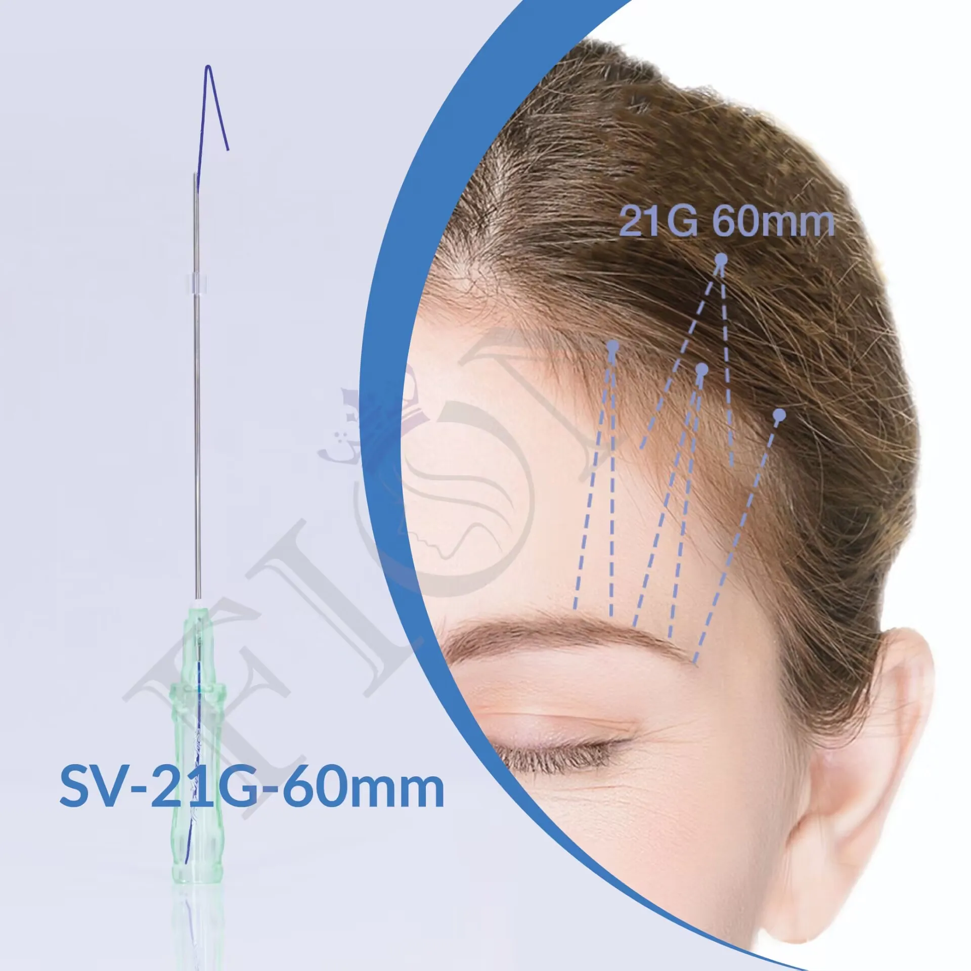 2024 Fios 6D barbed Cog Threads 21G 60mm/90mm for Fox eye lifting jawline lifting threads