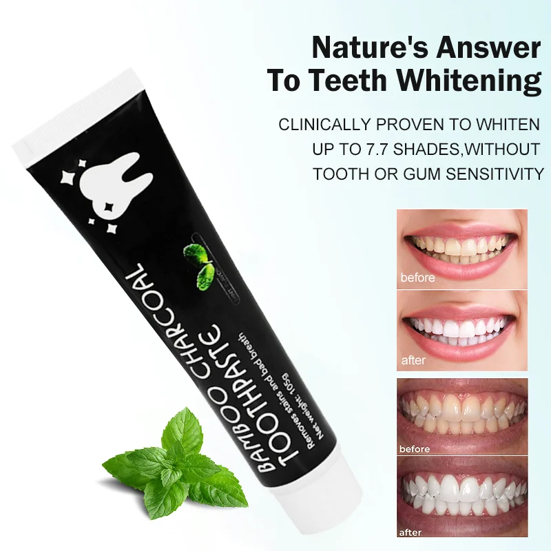 Cheap Price Stain Removal Whitening Toothpaste Teeth Whitening Activated Charcoal Toothpaste For Yellow Teeth