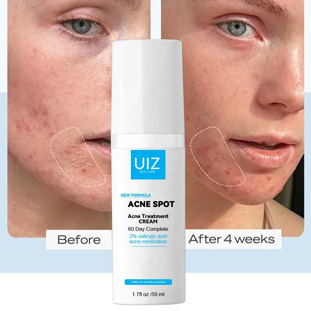 Private Label Natural Acne Cream Skin Care Repair Anti Acne Pimple Removal Salicylic Acid Cream