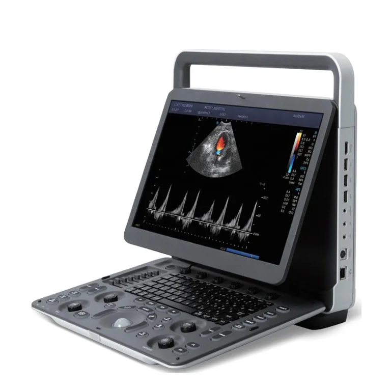 Ветеринарный ультразвуковой допплер Sonoscape E2V