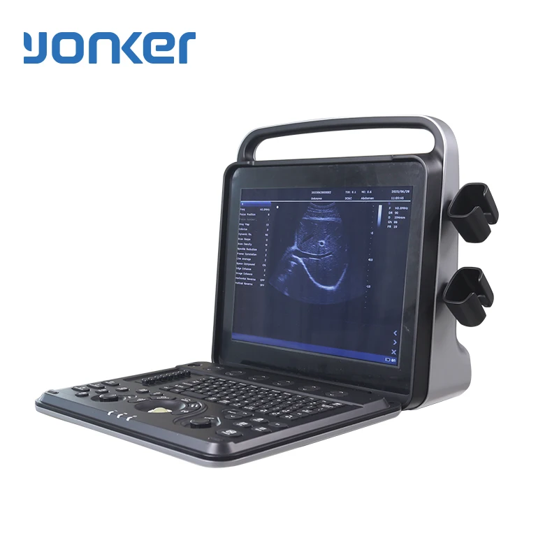 Yonker machine system with high quality portable laptop  with probes for clinic color ultrasound machine