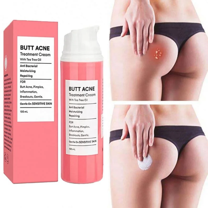 OEM/ODM Butt Cream Manufacturer Face Whitening Buttock Acne Mark Scar Supplier Body Bleaching Private Label butt acne cream