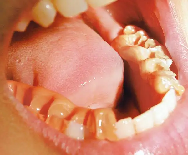 Bite Registration Hydrophilic Vinyl Polysiloxane 50ml