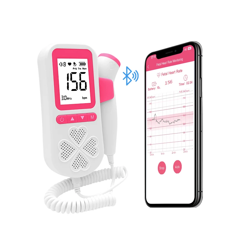 Remote Telehealth Record and Share Baby Heartbeat Monitor Fetal Doppler with App Mobile Phone Bluetooth Connect