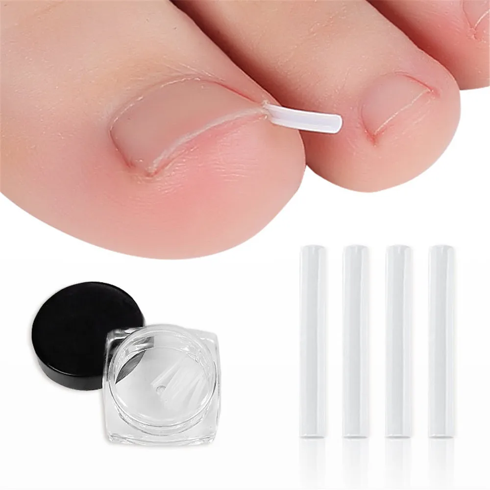 10pcs Ingrown Toenail Correction Tool Ingrown Toe Nail Treatment Elastic Patch Sticker Straightening Clip Brace Pedicure Tool