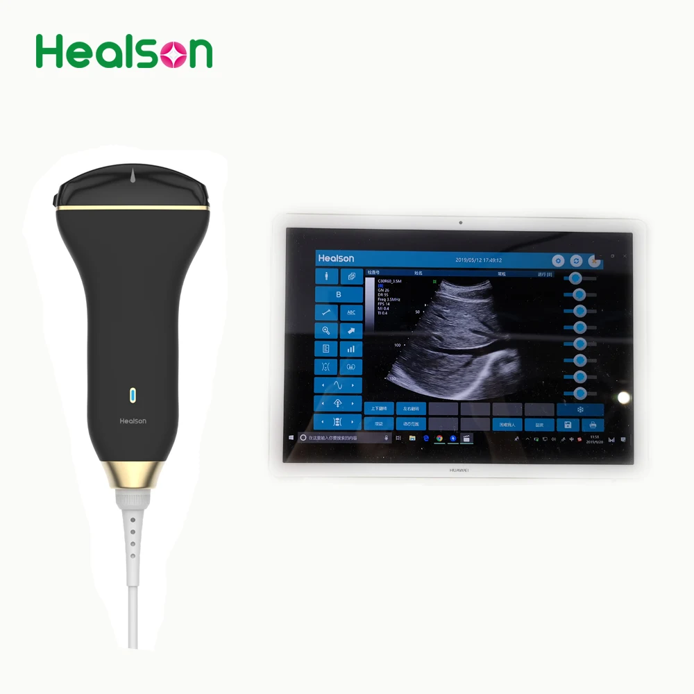  Ручной ультразвуковой допплер Healson C30 uprobe выпуклого цвета для смартфона