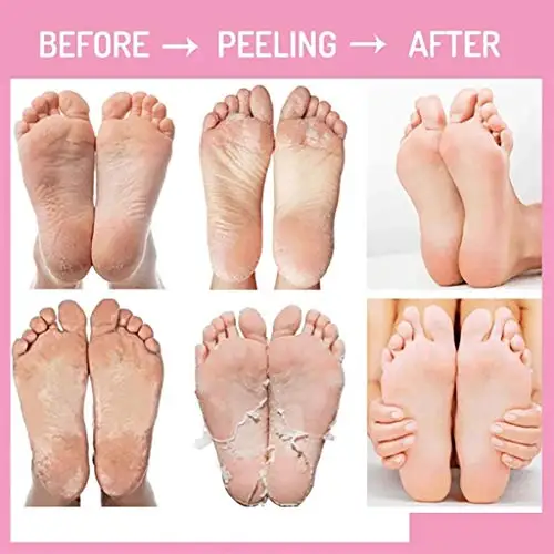 Private Label OEM Magic Purederm Braphy Callus Remover Pack Exfoliating Baby Foot Peeling Mask foot soak