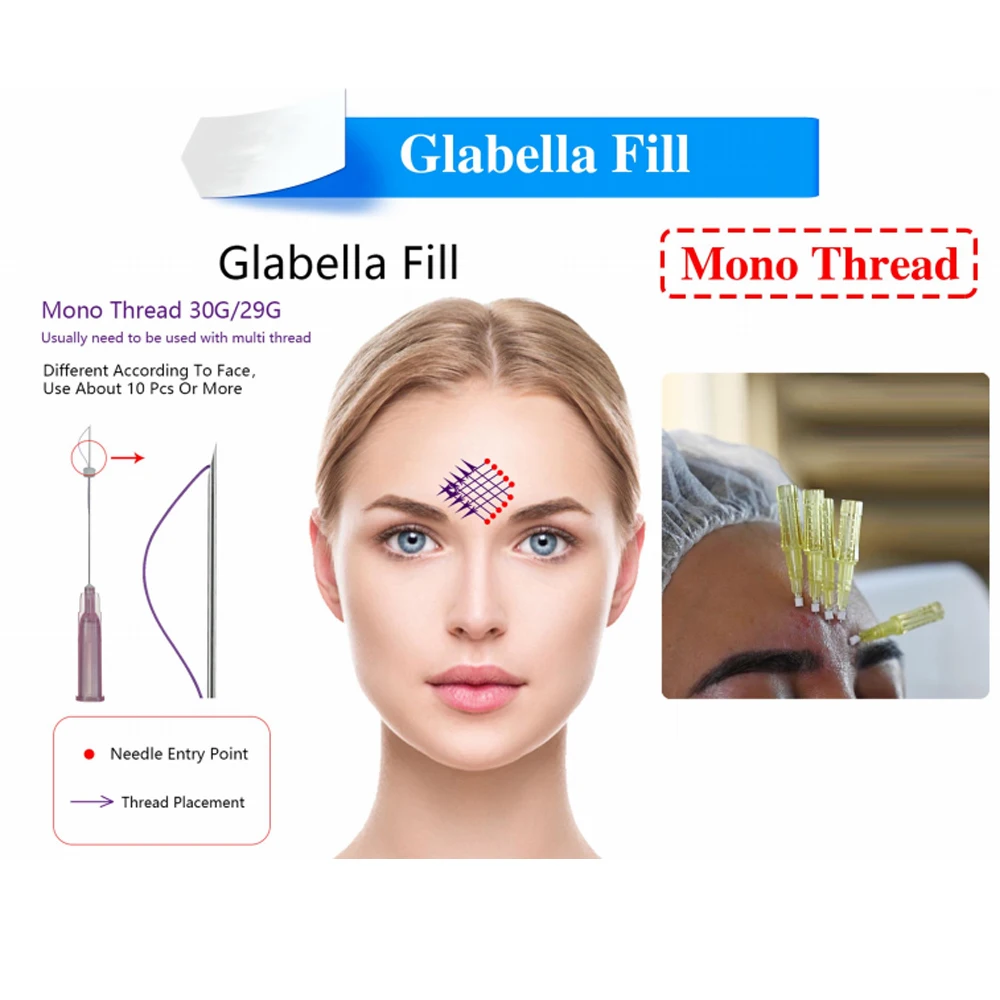 Beauty Clinic 30g 25mm Face Filling Hilos Type B Fios De Pdo Lift Mono Thread