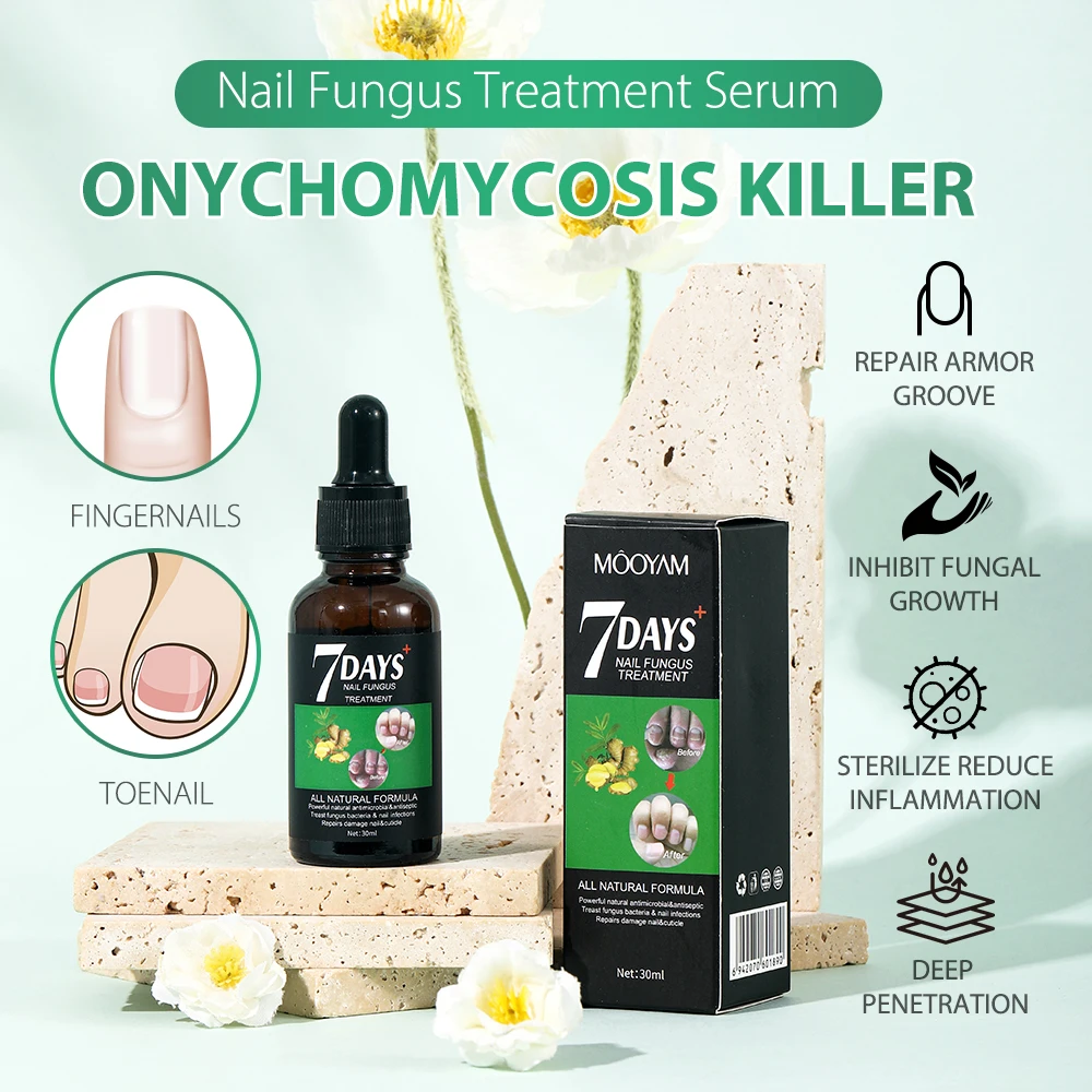 30ml MOOYAM 7 Days Fingernails Toenails Fungus Treatment Serum Repairs Damage and Treat Fungal Bacterial Infections Nail Serum