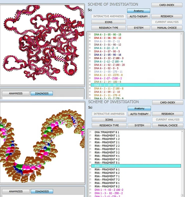 Английский 5,98 NLS 12D Iris synapse AURA Chakra, анализатор здоровья тела с датчиком шлема