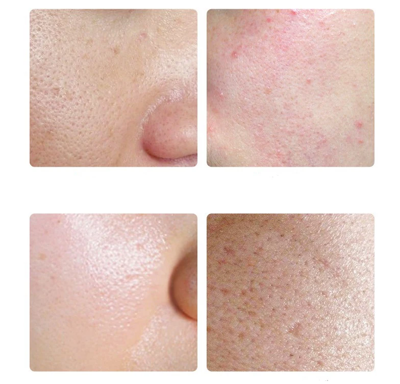 Private Label Ginseng Black Ganoderma Herbal Organic Face Cream Moisturizing Smooth Oil Control Luxury Beauty Face Cream